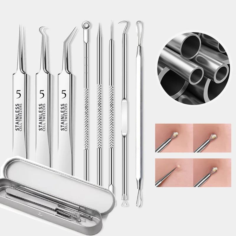 Pickel-Entfernungsset